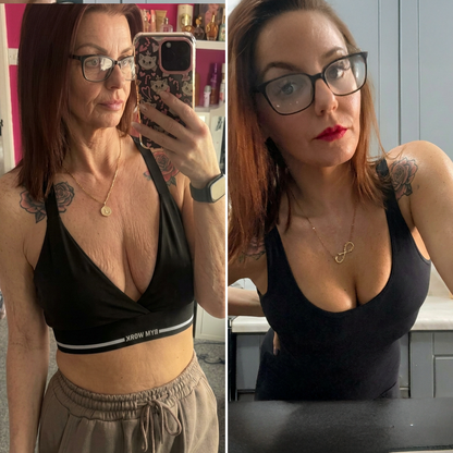 💕HISKIN® mikroihličkové náplasti na podporu plnšieho pevnejšieho a pozdvihnutejšieho vzhľadu poprsia a krajších kontúr | Jednoduchá každodenná starostlivosť o dekolt ✨