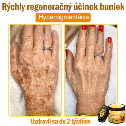 🌻 Sinvie® Krém na obnovu pokožky s včelím jedom 🔥 Odporúčané dermatológmi | Proti vráskam, pigmentovým škvrnám a ochabnutej pokožke – 50 ml