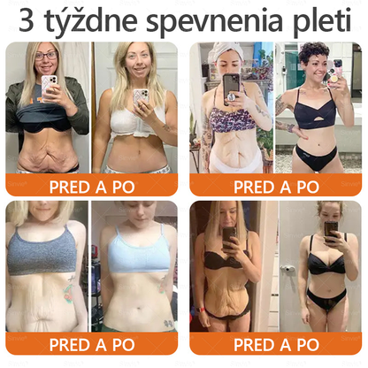🌻 Sinvie® Krém na obnovu pokožky s včelím jedom 🔥 Odporúčané dermatológmi | Proti vráskam, pigmentovým škvrnám a ochabnutej pokožke – 50 ml