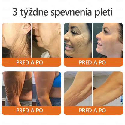 🌻 Sinvie® Krém na obnovu pokožky s včelím jedom 🔥 Odporúčané dermatológmi | Proti vráskam, pigmentovým škvrnám a ochabnutej pokožke – 50 ml