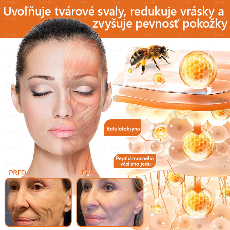 🌻 Sinvie® Krém na obnovu pokožky s včelím jedom 🔥 Odporúčané dermatológmi | Proti vráskam, pigmentovým škvrnám a ochabnutej pokožke – 50 ml
