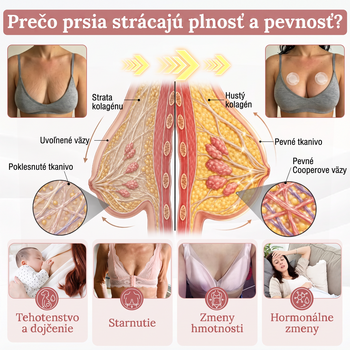 💕HISKIN® mikroihličkové náplasti na podporu plnšieho pevnejšieho a pozdvihnutejšieho vzhľadu poprsia a krajších kontúr | Jednoduchá každodenná starostlivosť o dekolt ✨