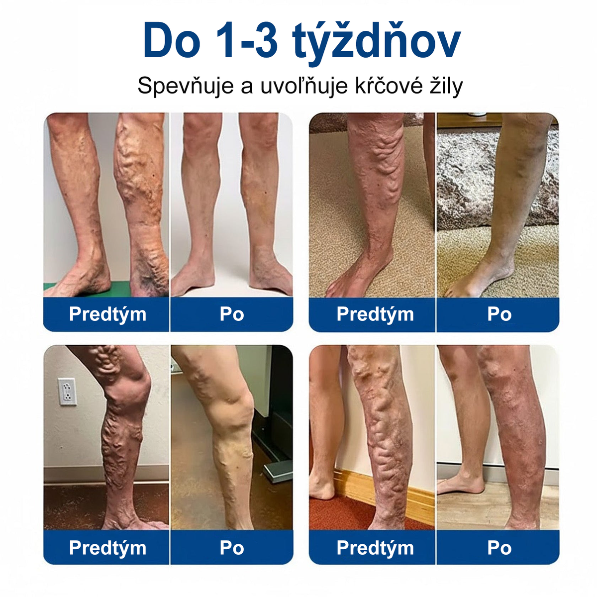👨‍⚕️✅ Medistart® VeinRepair – mikrotűs ápoló tapasz ⚡ Azonnali megkönnyebbülés, hosszan tartó eredmény