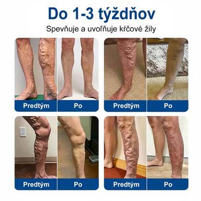 👨‍⚕️✅ Medistart® VeinRepair – mikrotűs ápoló tapasz ⚡ Azonnali megkönnyebbülés, hosszan tartó eredmény