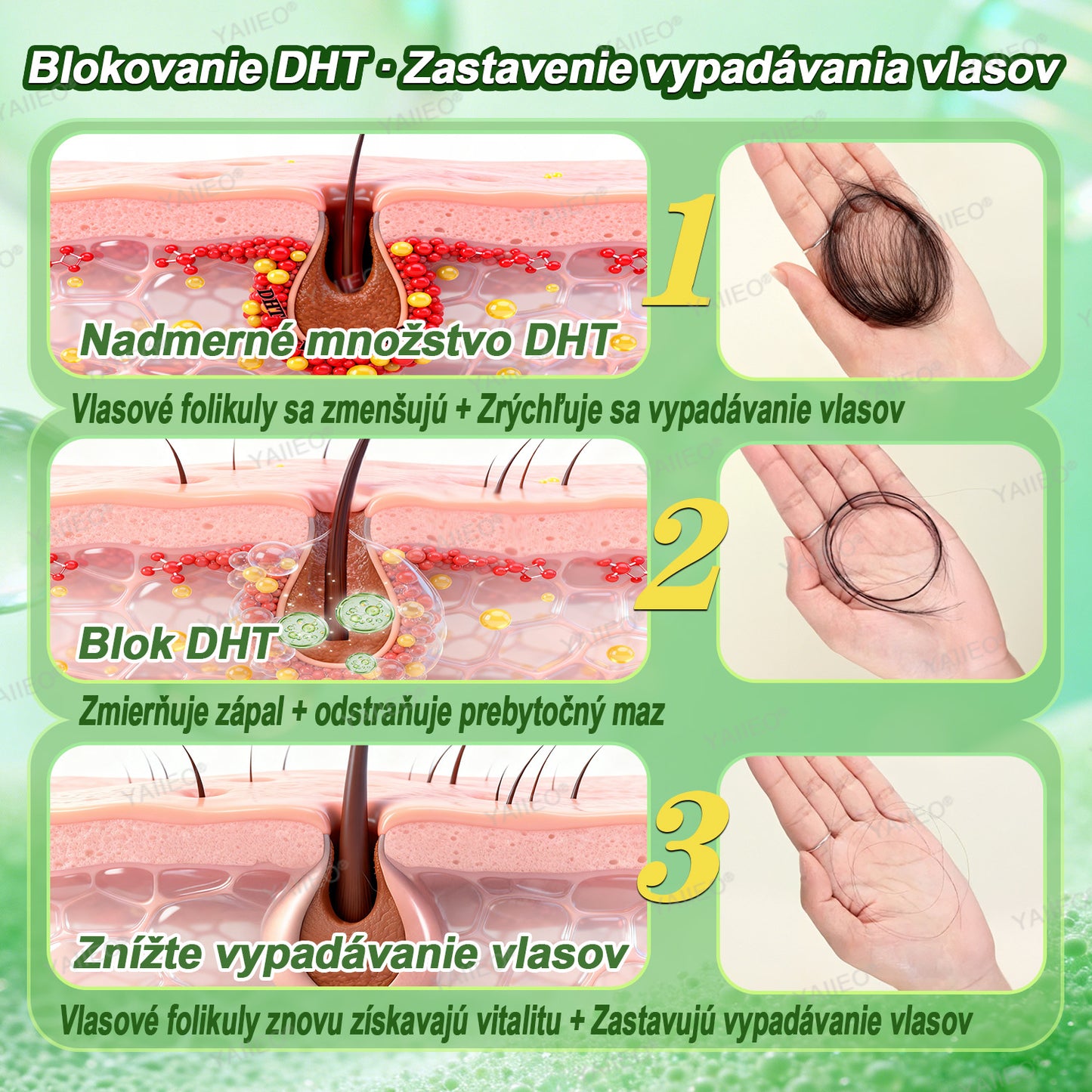 🍌𝐘𝐀𝐈𝐈𝐄𝐎® 𝑭á𝒋𝒅𝒂𝒍𝒐𝒎𝒎𝒆𝒏𝒕𝒆𝒔 𝑴𝒊𝒌𝒓𝒏💛 𝑹𝒆𝒏𝒅𝒔𝒛𝒆𝒓 Hlboko pôsobiace blokovanie DHT, reaktivácia vlasových folikulov a viditeľný rast vlasov