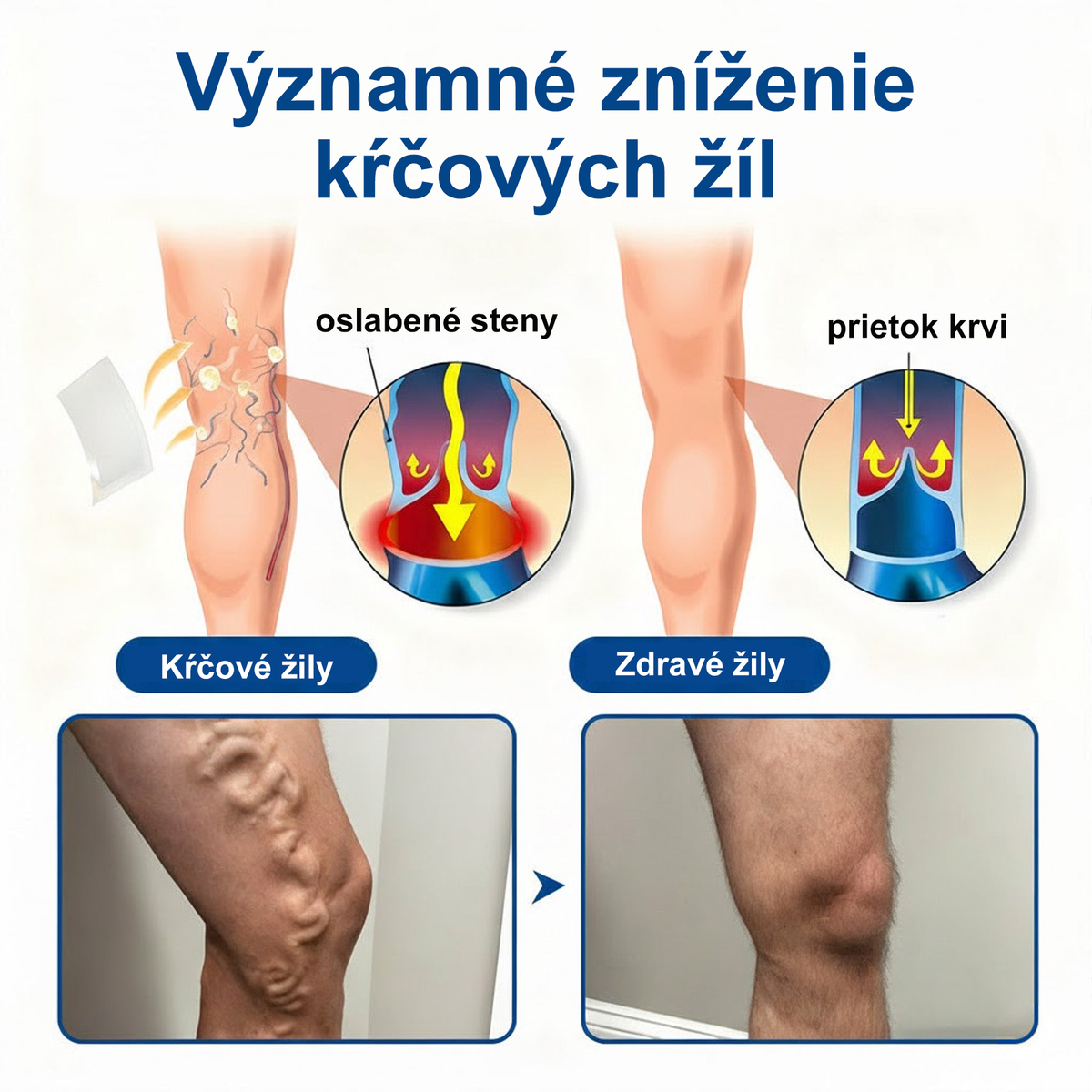 👨‍⚕️✅ Medistart® VeinRepair – mikrotűs ápoló tapasz ⚡ Azonnali megkönnyebbülés, hosszan tartó eredmény