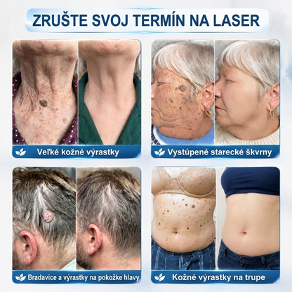 PuraCure® 👩‍⚕️ 7-dňové pero na odstraňovanie kožných výrastkov a znamienok – bezbolestný a bez jaziev, profesionálny valčekový aplikátor