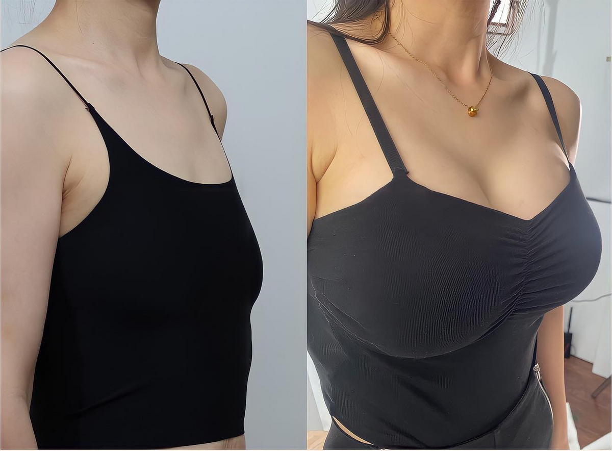 💕HISKIN® mikroihličkové náplasti na podporu plnšieho pevnejšieho a pozdvihnutejšieho vzhľadu poprsia a krajších kontúr | Jednoduchá každodenná starostlivosť o dekolt ✨