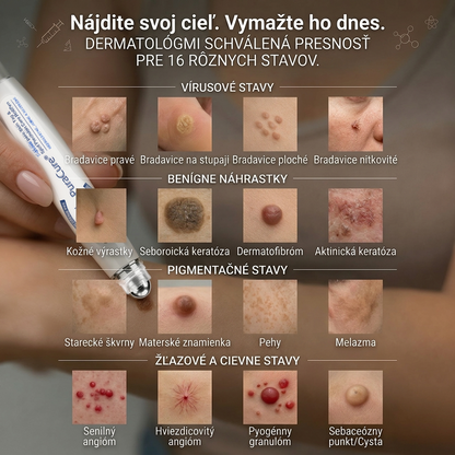 PuraCure® 👩‍⚕️ 7-dňové pero na odstraňovanie kožných výrastkov a znamienok – bezbolestný a bez jaziev, profesionálny valčekový aplikátor