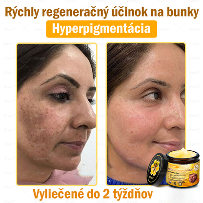 🌻 Sinvie® Krém na obnovu pokožky s včelím jedom 🔥 Odporúčané dermatológmi | Proti vráskam, pigmentovým škvrnám a ochabnutej pokožke – 50 ml