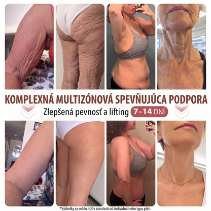 💕HISKIN® mikroihličkové náplasti na podporu plnšieho pevnejšieho a pozdvihnutejšieho vzhľadu poprsia a krajších kontúr | Jednoduchá každodenná starostlivosť o dekolt ✨